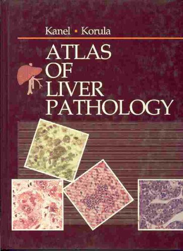 Atlas of Liver Pathology