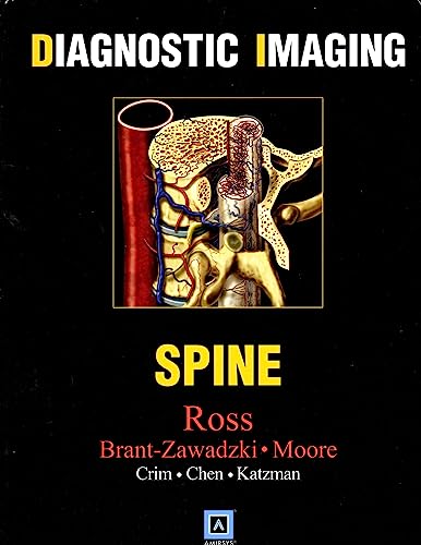 9780721628806: Spine (Diagnostic Imaging)