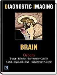 Stock image for Diagnostic Imaging: Brain for sale by Jenson Books Inc