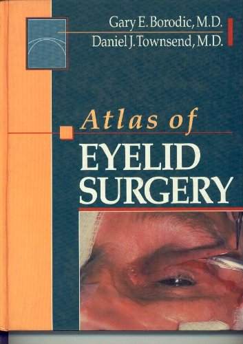 Imagen de archivo de Atlas of Eyelid Surgery a la venta por HPB-Red