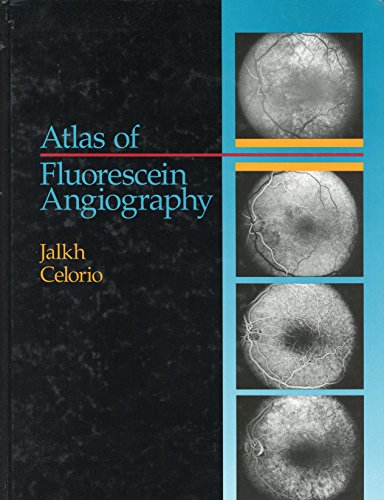 Stock image for Atlas of Fluorescein Angiography for sale by Mispah books