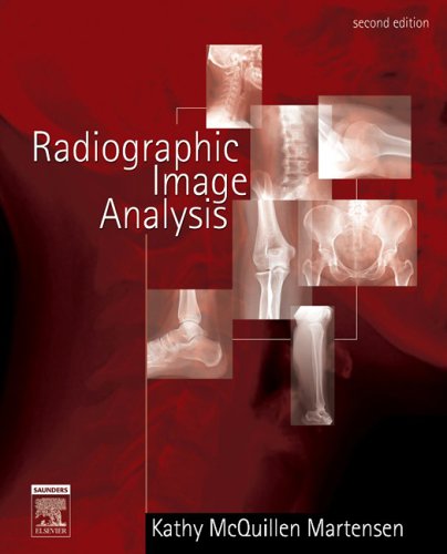 9780721639253: Radiographic Image Analysis