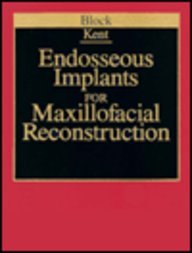 9780721639581: Endosseous Implants for Maxillofacial Reconstruction