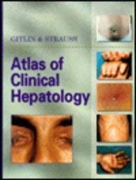 Stock image for ATLAS OF CLINICAL HEPATOLOGY for sale by BennettBooksLtd