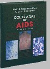 Imagen de archivo de Color Atlas of AIDS a la venta por SecondSale