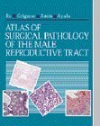 Imagen de archivo de Atlas of Surgical Pathology of the Male Reproductive Tract a la venta por Better World Books