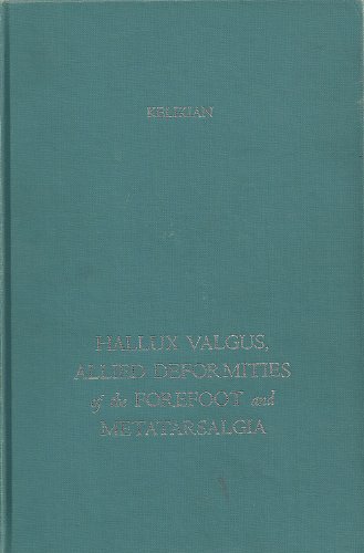 Beispielbild fr Hallux Valgus, Allied Deformities of the Forefoot and Metatarsalgia zum Verkauf von Better World Books