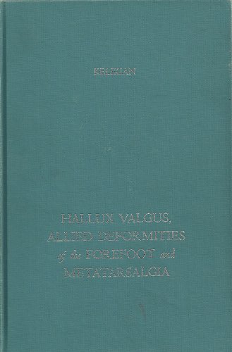 Imagen de archivo de Hallux Valgus, Allied Deformities of the Forefoot and Metatarsalgia a la venta por Better World Books