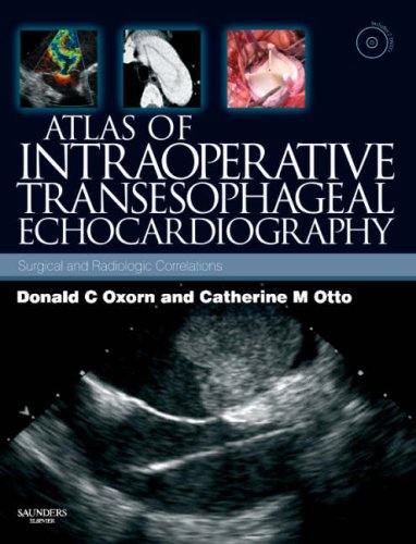 9780721653563: Atlas of Intraoperative Transesophageal Echocardiography: Surgical and Radiologic Correlations, Text with DVD, 1e