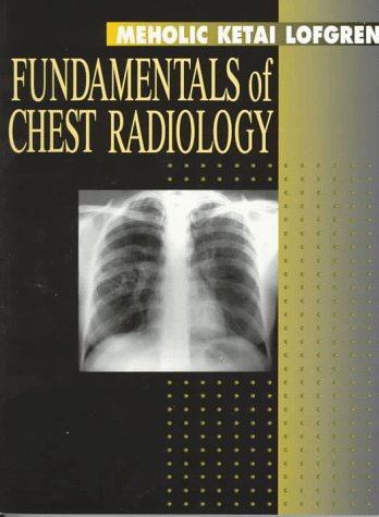 Imagen de archivo de Fundamentals of Chest Radiology a la venta por ThriftBooks-Atlanta
