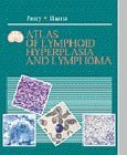 Beispielbild fr Atlas of Lymphoid Hyperplasia and Lymphoma zum Verkauf von HPB-Red