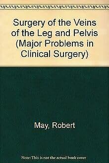 Beispielbild fr Surgery of the Veins of the Leg and Pelvis (Major Problems in Clinical Surgery S.) zum Verkauf von medimops