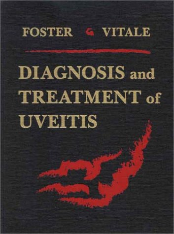 9780721663388: Diagnosis and Treatment of Uveitis