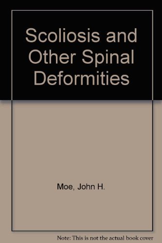Imagen de archivo de Scoliosis and other spinal deformities a la venta por Byrd Books