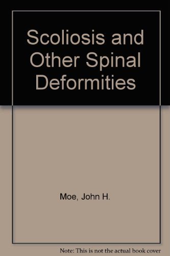 Scoliosis and other spinal deformities