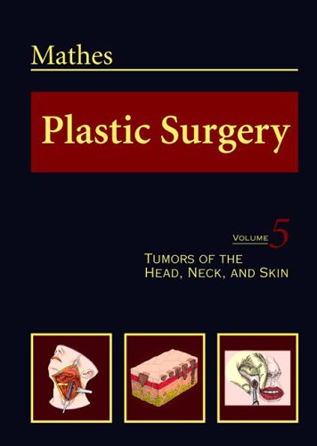 Plastic Surgery, Vol. 5: Tumors of the Head, Neck, and Skin (9780721688169) by Stephen J. Mathes