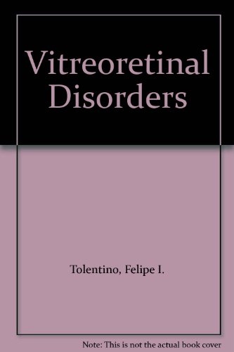 Stock image for Vitreoretinal disorders: Diagnosis and management for sale by HPB-Red
