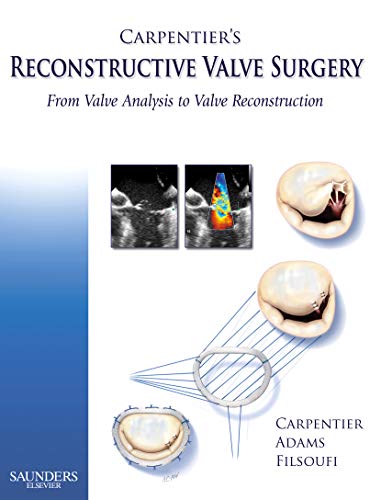 9780721691688: Carpentier's Reconstructive Valve Surgery, 1e