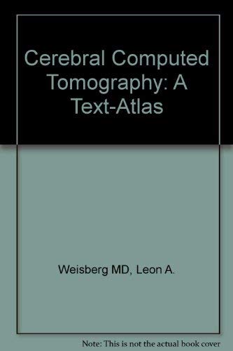 Cerebral Computed Tomography: A Text Atlas (9780721691831) by Weisberg, Leon A.; Nice, Charles