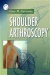 9780721694887: Shoulder arthroscopy