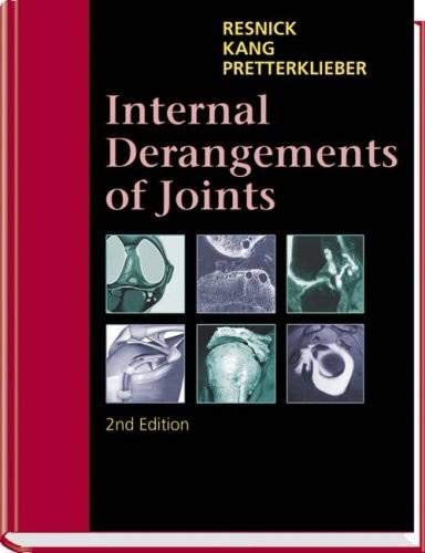 9780721695525: Internal Derangements of Joints: Vol. I an Vol. II