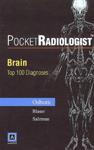 Stock image for PocketRadiologist: Brain Top 100 Diagnoses for sale by HPB-Red