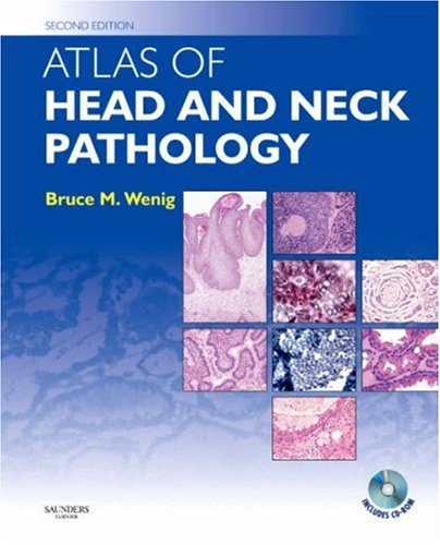 9780721697888: Atlas of Head and Neck Pathology with CD-ROM, 2e (ATLAS OF SURGICAL PATHOLOGY)