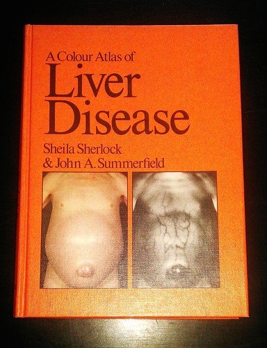 Beispielbild fr A Colour Atlas of Liver Disease zum Verkauf von Better World Books Ltd