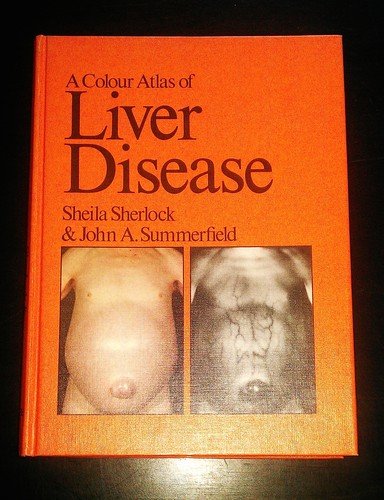Stock image for A Colour Atlas of Liver Disease for sale by Better World Books Ltd