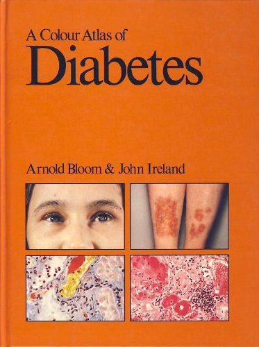 Stock image for A Colour Atlas of Diabetes for sale by PsychoBabel & Skoob Books
