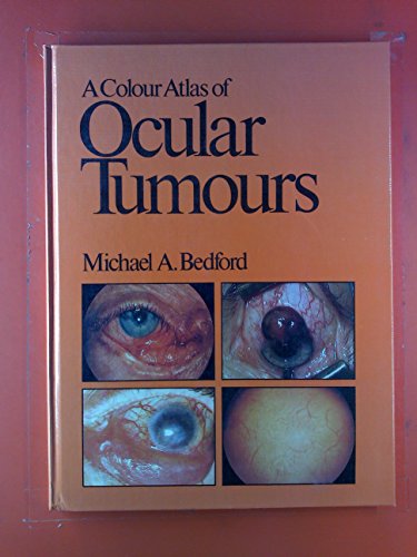 9780723407300: A Colour Atlas of Ocular Tumours (Wolfe medical atlases)