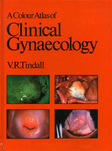 9780723407614: A Colour Atlas of Clinical Gynaecology