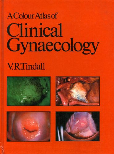 9780723407614: A Colour Atlas of Clinical Gynaecology (Wolfe medical atlases)