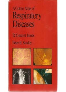 9780723407621: A Colour Atlas of Respiratory Diseases