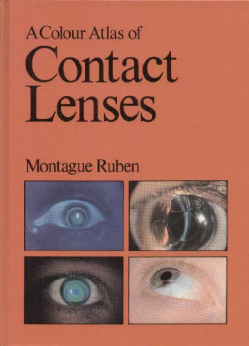 Imagen de archivo de A Colour (Colour) Atlas of Contact Lenses (& Prosthetics) a la venta por Book Bungalow