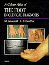 9780723408130: Color Atlas of Foot Conditions