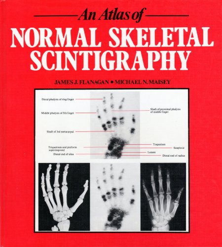Stock image for An Atlas of Normal Anatomy in Skeletal Scintigraphy for sale by Cotswold Rare Books
