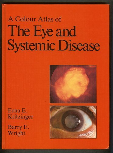 Beispielbild fr A Colour Atlas of the Eye and Systemic Diseases (Wolfe medical atlases) zum Verkauf von WorldofBooks
