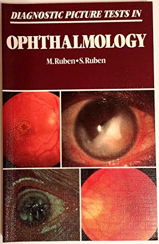 Imagen de archivo de Diagnostic Picture Tests in Ophthalmology a la venta por dsmbooks