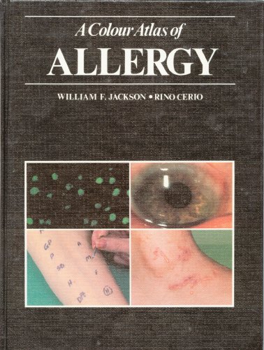 Beispielbild fr A Color Atlas of Allergy zum Verkauf von PsychoBabel & Skoob Books