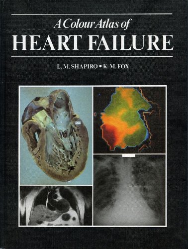 9780723409359: A Colour Atlas of Heart Failure