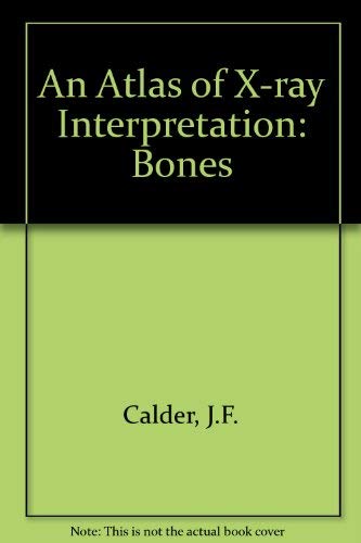 Stock image for An Atlas of Radiological Interpretation: The Bones for sale by HPB-Red