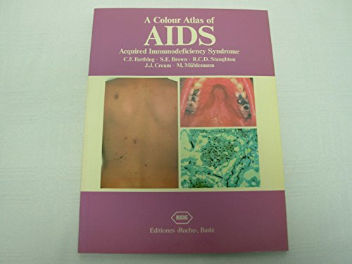 Beispielbild fr A Colour Atlas of AIDS: Acquired Immunodeficiency Syndrome zum Verkauf von Wonder Book