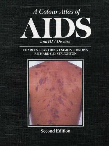 Beispielbild fr A Colour Atlas of AIDS zum Verkauf von Ammareal