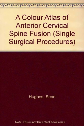 Beispielbild fr A Colour Atlas of Anterior Cervical Spine Fusion (Single Surgical Procedures) zum Verkauf von HPB-Red