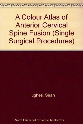 Imagen de archivo de A Colour Atlas of Anterior Cervical Spine Fusion (Single Surgical Procedures) a la venta por HPB-Red