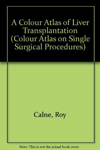 A Colour Atlas of Liver Transplantation (Single Surgical Procedures) (9780723410447) by Calne, Roy Y.