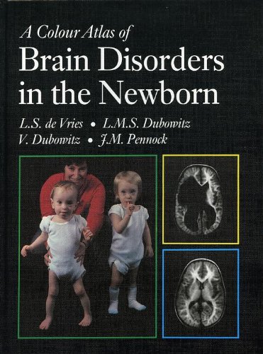 Beispielbild fr A Colour Atlas of Brain Disorders in the Newborn zum Verkauf von Anybook.com