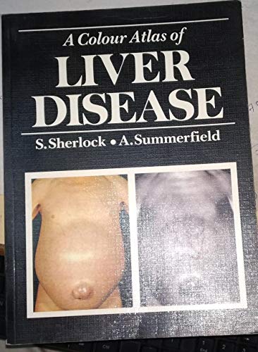 9780723415589: A Colour Atlas of Liver Disease