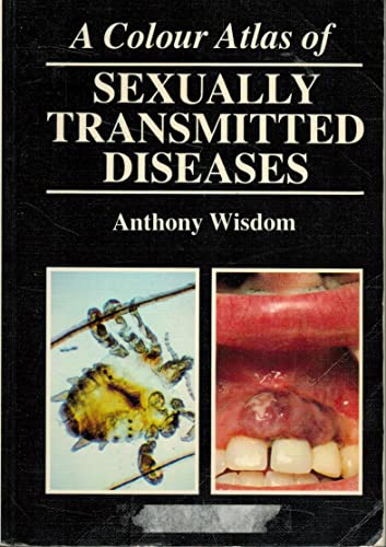 9780723415923: A Colour Atlas of Sexually Transmitted Diseases